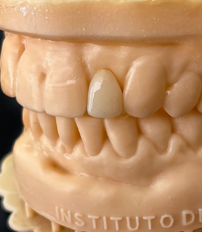 Próteses Dentárias